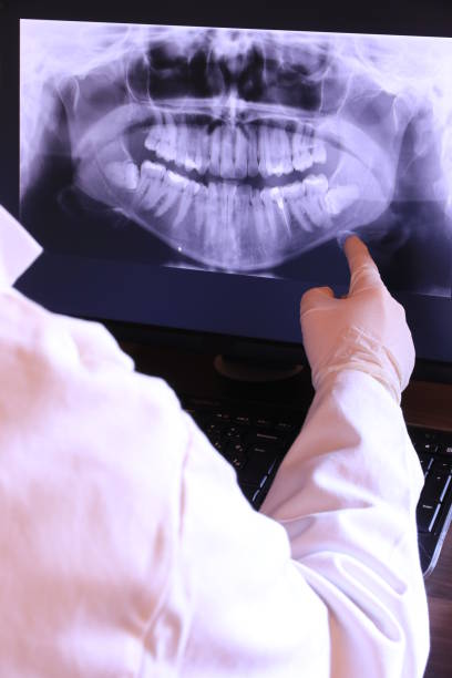 Best Emergency Tooth Extraction in Shelby, NC