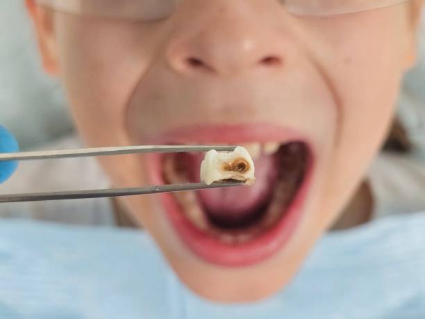 Best Pediatric Emergency Dentist in Shelby, NC